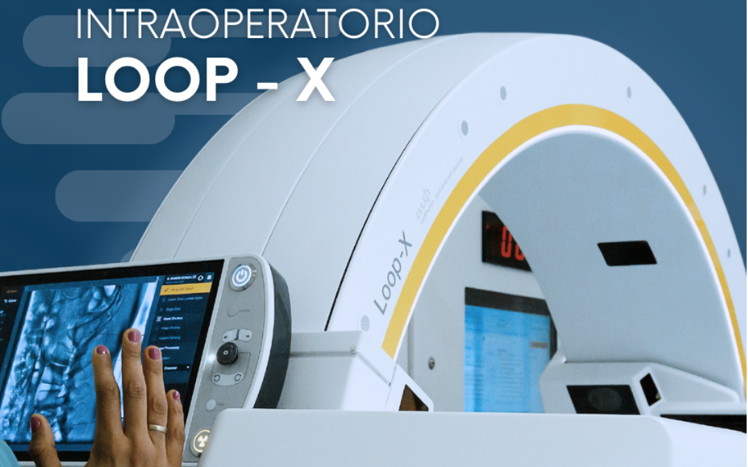 La exactitud en cirugía: TAC automatizado intraoperatorio LOOP-X de Brainlab
