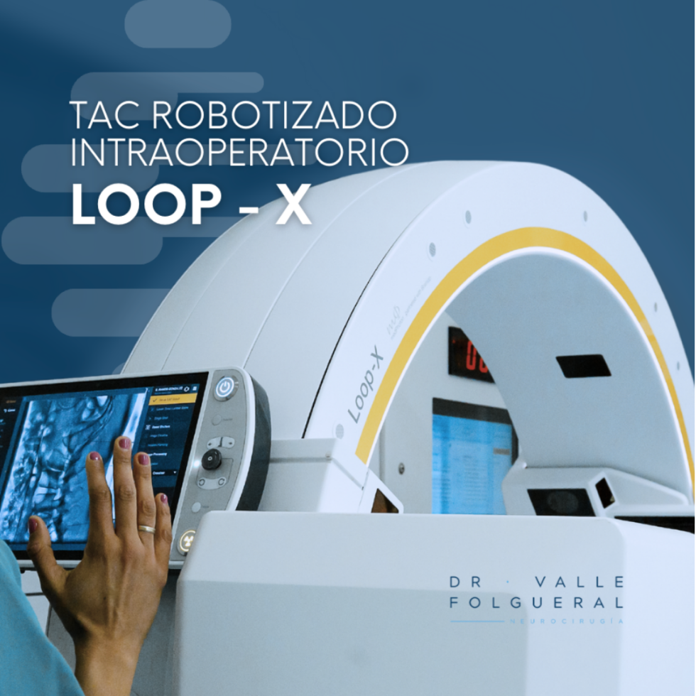 La exactitud en cirugía TAC automatizado intraoperatorio LOOPX de